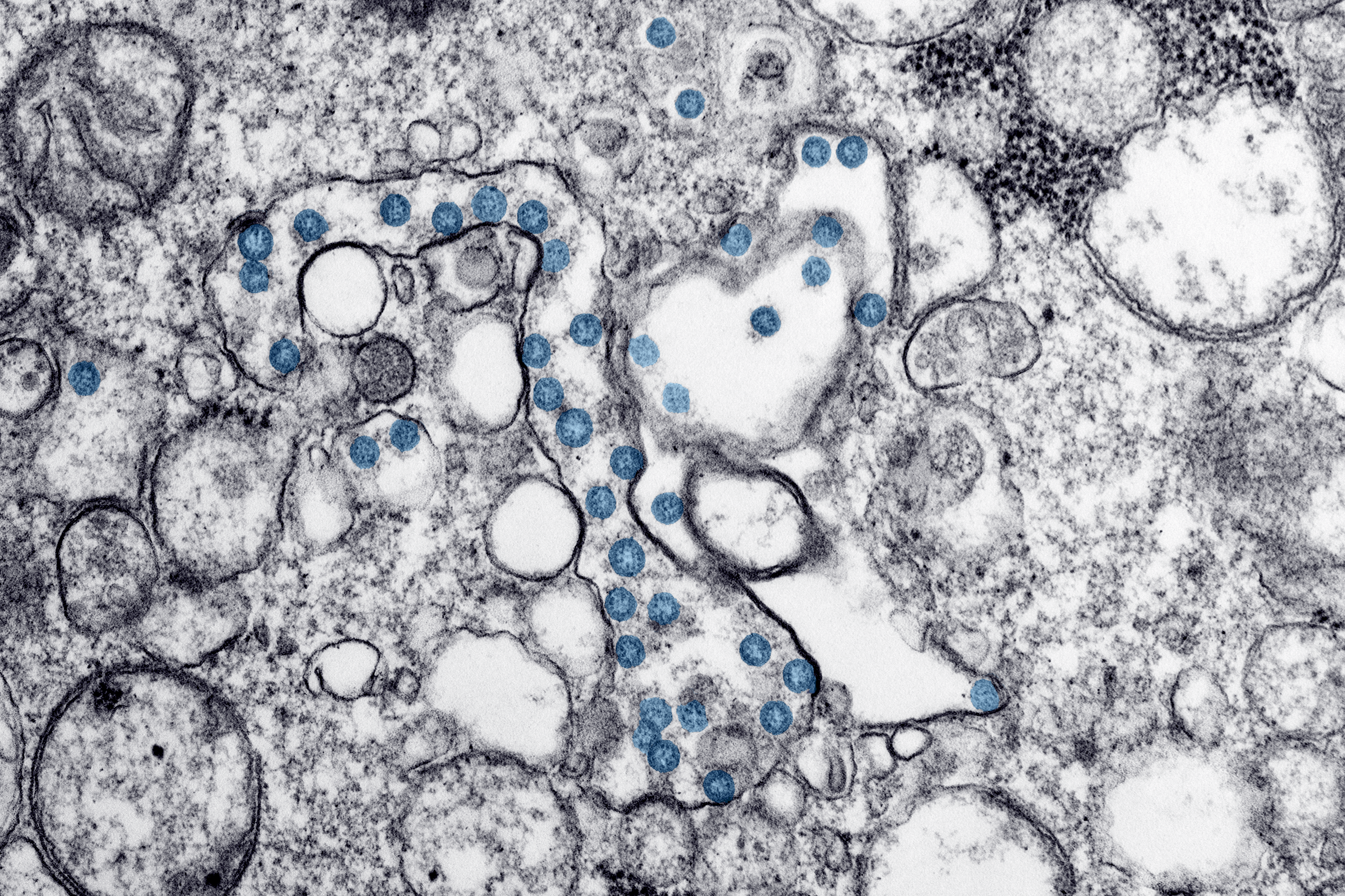Image of the microscopic virus
