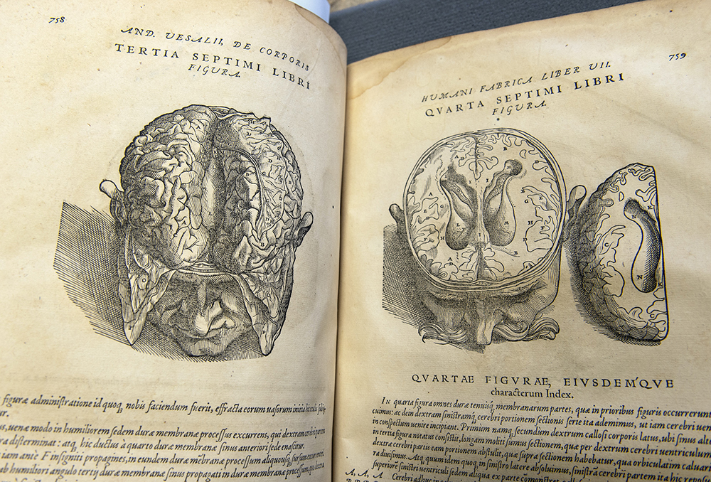 An illustration of a skull and brain from 